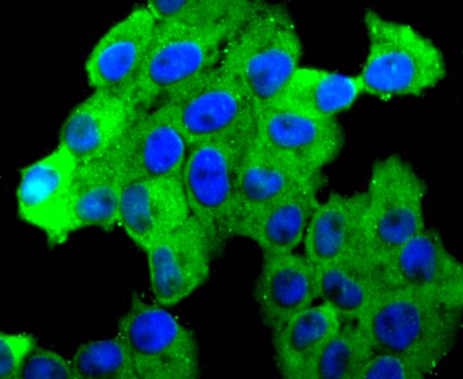 N Cadherin Rabbit mAb