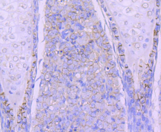 N Cadherin Rabbit mAb