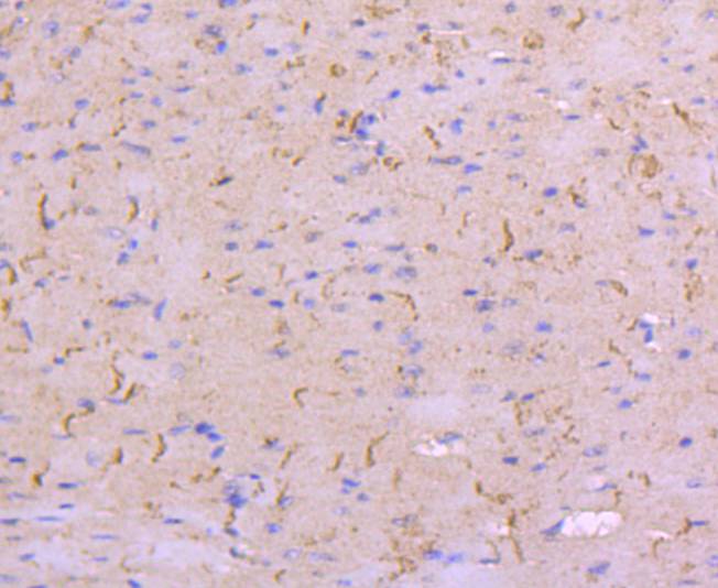 N Cadherin Rabbit mAb