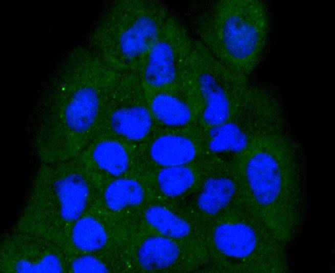 NADPH oxidase 4/NOX4 Rabbit mAb