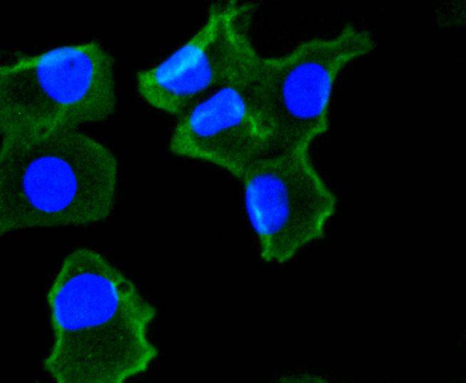 NADPH oxidase 4/NOX4 Rabbit mAb