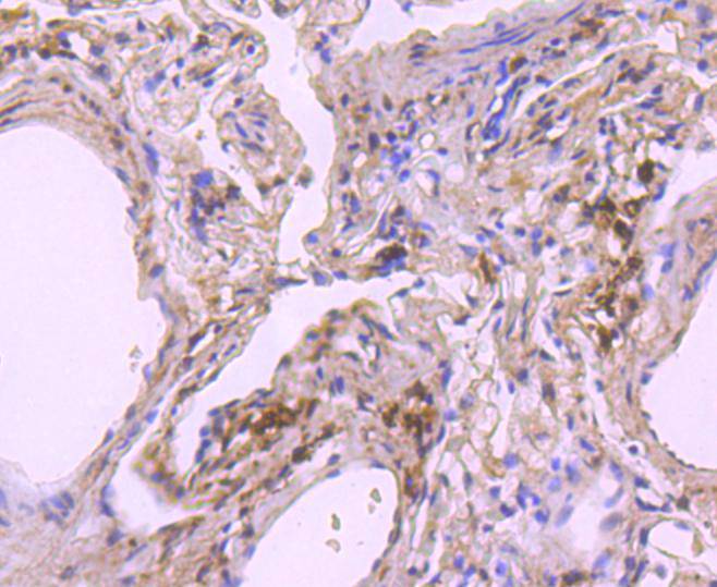 NADPH oxidase 4/NOX4 Rabbit mAb