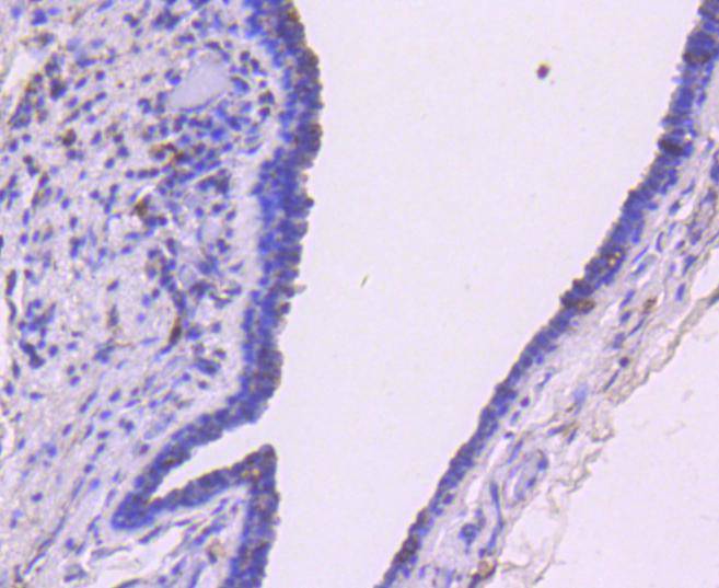 Smad3 Rabbit mAb