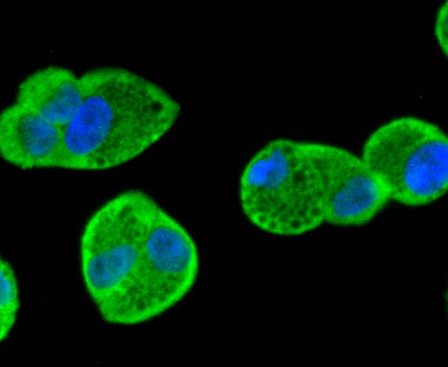 Smad1 Rabbit mAb