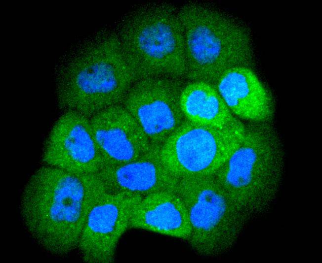 Smad1 Rabbit mAb