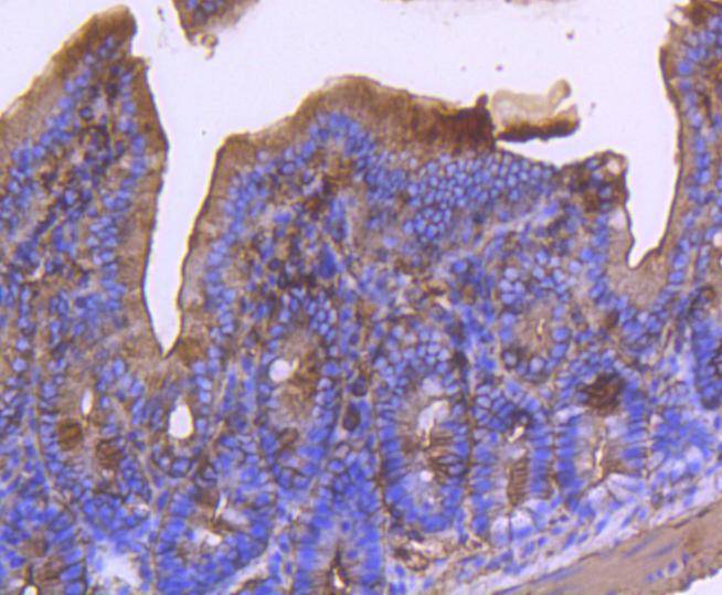 alpha smooth muscle Actin Rabbit mAb