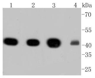 alpha smooth muscle Actin Rabbit mAb