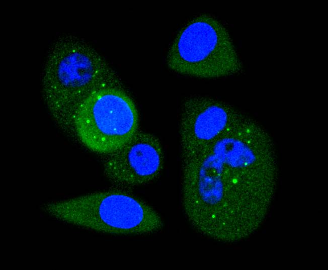 CDK1 Rabbit mAb