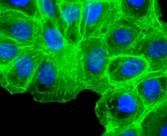 alpha smooth muscle Actin Rabbit mAb