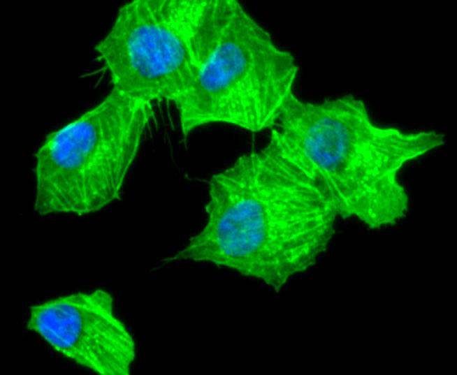 alpha smooth muscle Actin Rabbit mAb