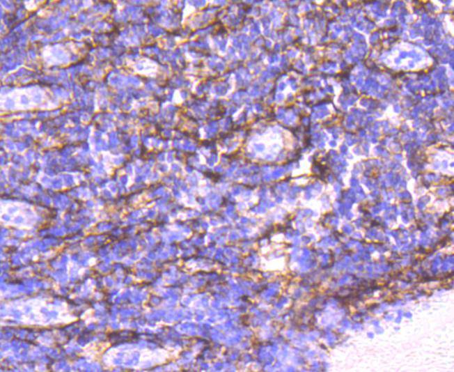 alpha smooth muscle Actin Rabbit mAb