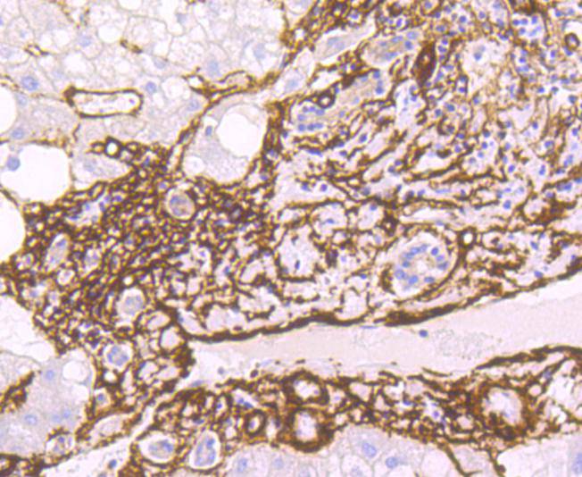 alpha smooth muscle Actin Rabbit mAb