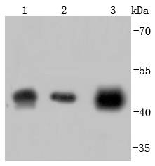 alpha smooth muscle Actin Rabbit mAb