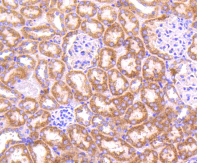 Topoisomerase Ⅱ alpha Rabbit mAb