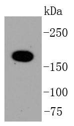 Topoisomerase Ⅱ alpha Rabbit mAb