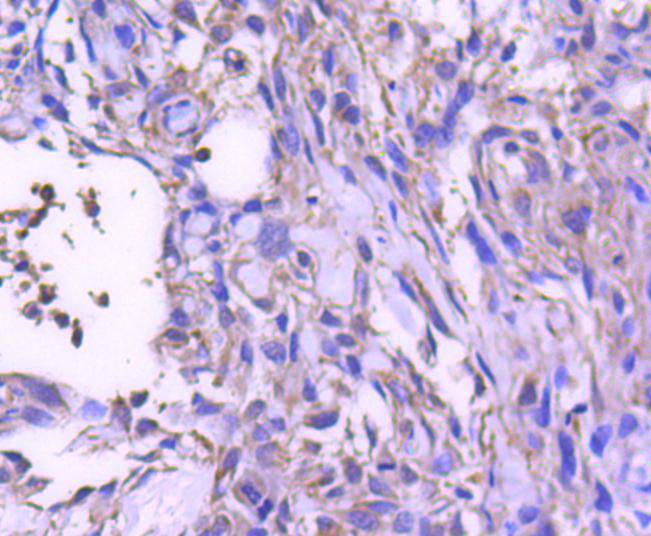 STAT6 Rabbit mAb