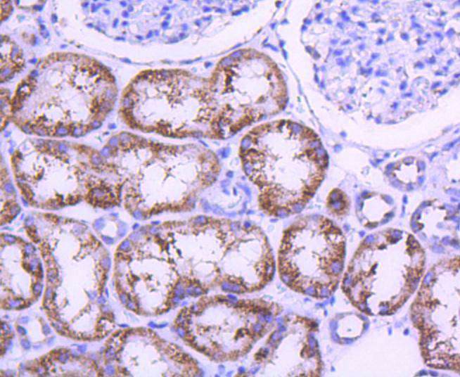 STAT6 Rabbit mAb