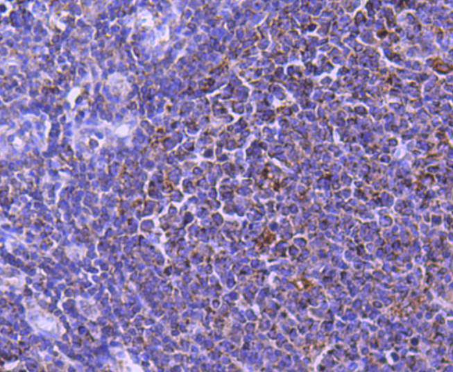 STAT6 Rabbit mAb