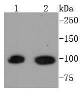 STAT6 Rabbit mAb