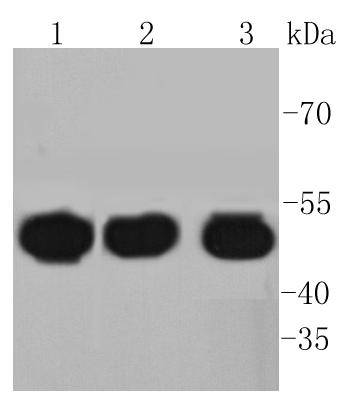 HAPLN1 Rabbit mAb