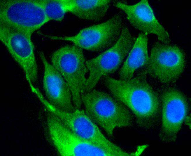 GSK3 beta Rabbit mAb