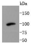 PI 3 Kinase Class 3 Rabbit mAb