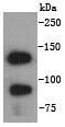 E Cadherin Rabbit mAb