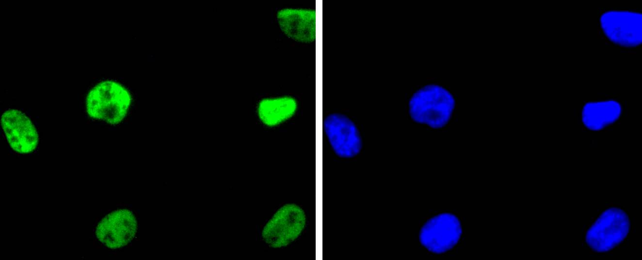 HDAC2 Rabbit mAb