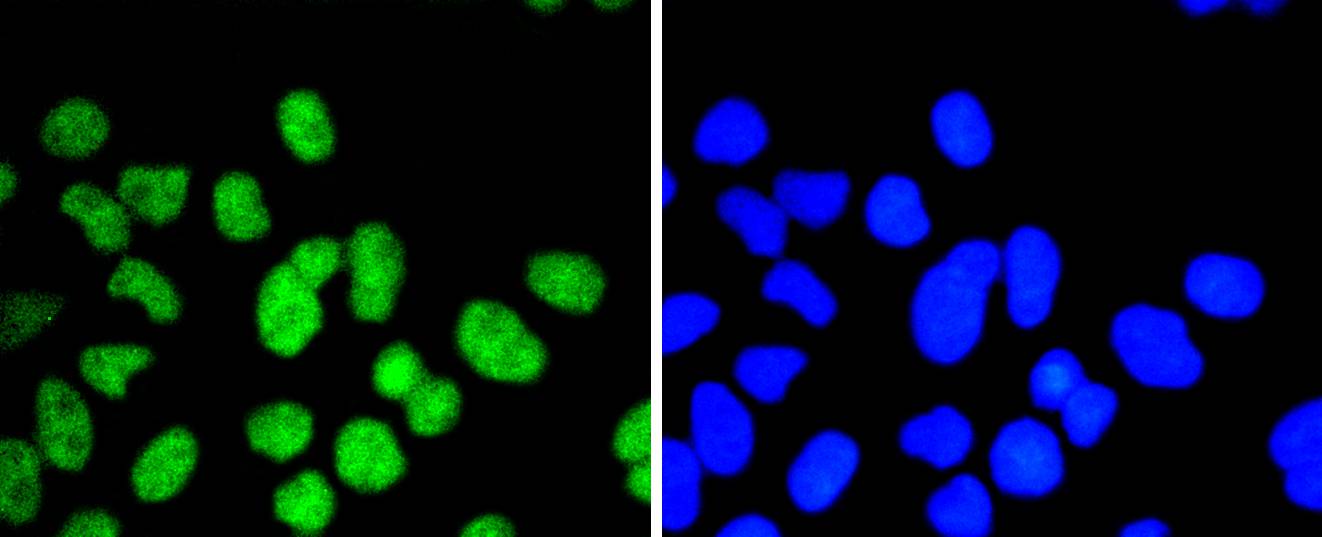 ELK1 Rabbit mAb