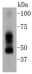 ELK1 Rabbit mAb