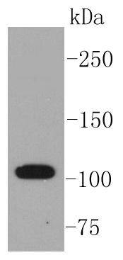 ABCG1 Rabbit mAb