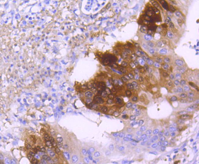 DARPP32 Rabbit mAb