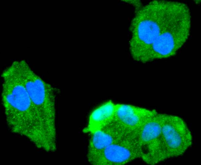 FOXO1A Rabbit mAb