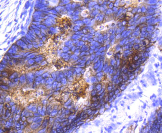 EpCAM Rabbit mAb