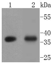 EpCAM Rabbit mAb