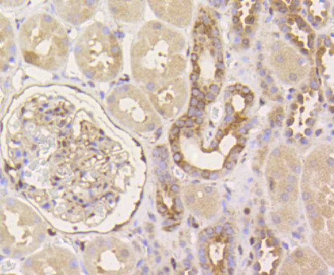 YAP1 Rabbit mAb