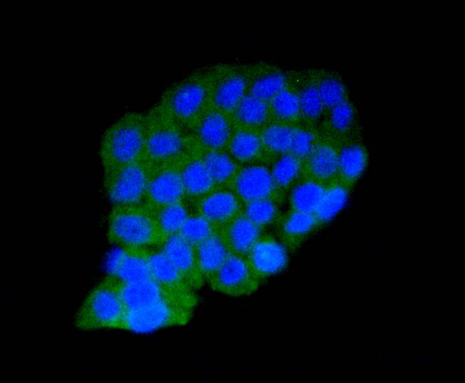 AMPK alpha 1 Rabbit mAb