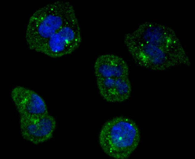 TrkA Rabbit mAb