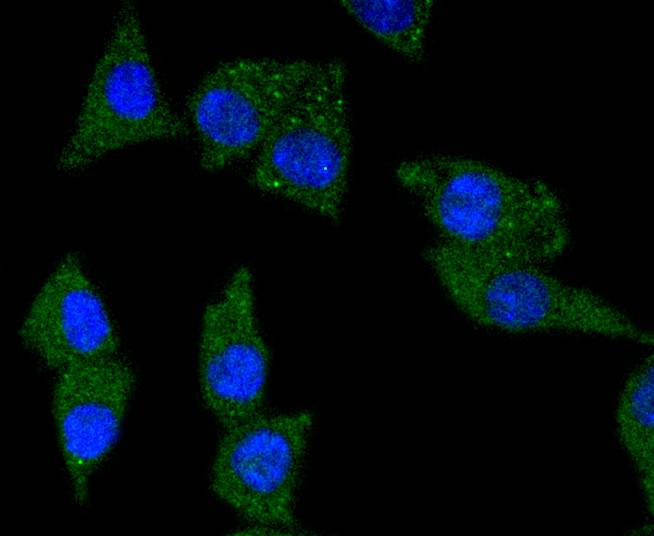 TrkA Rabbit mAb