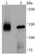 TrkA Rabbit mAb