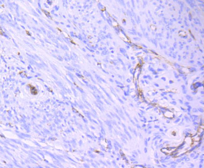 CD31 Rabbit mAb