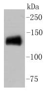 CD31 Rabbit mAb