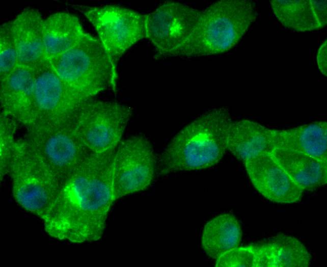 Cathepsin D Rabbit mAb