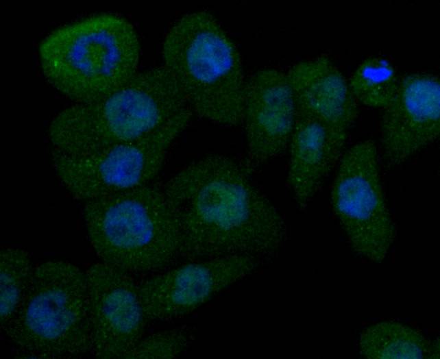 Cathepsin D Rabbit mAb