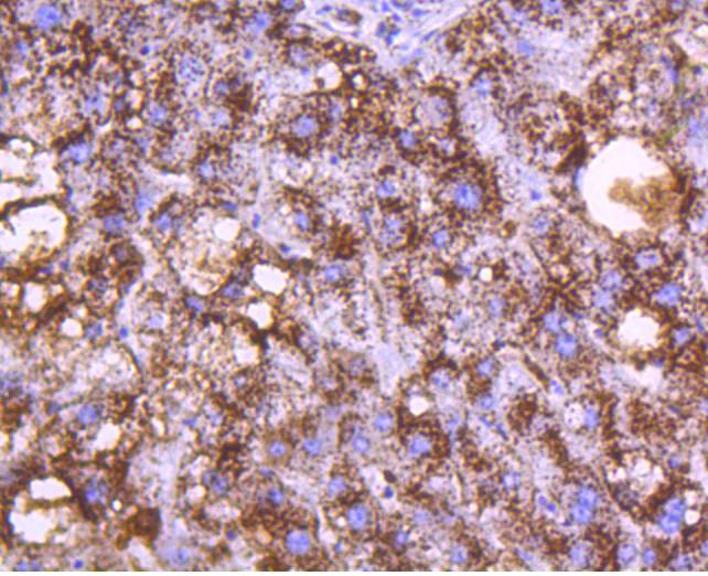 Cathepsin D Rabbit mAb