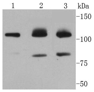 PARP Rabbit mAb