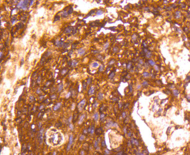 Lactate Dehydrogenase Rabbit mAb