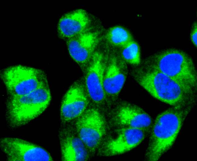 Calreticulin Rabbit mAb