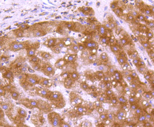 Calreticulin Rabbit mAb