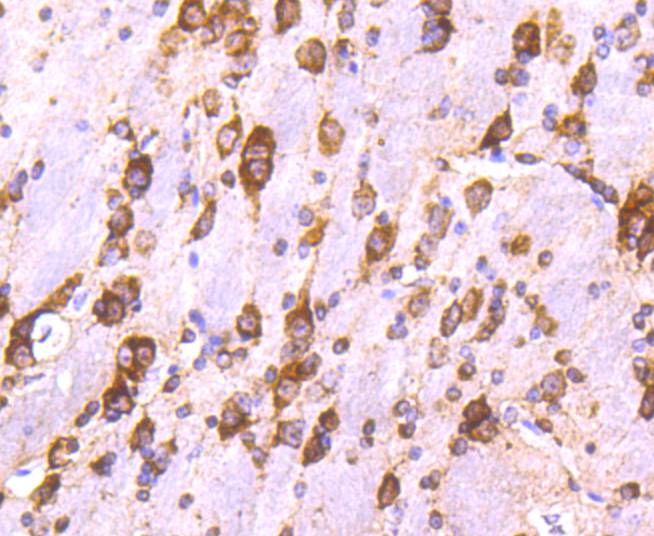 Calreticulin Rabbit mAb